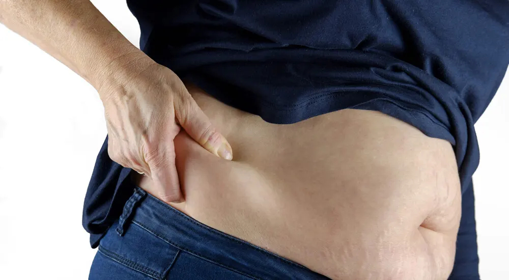 Excesso de peso - O índice de massa corporal é um indicativo de obesidade